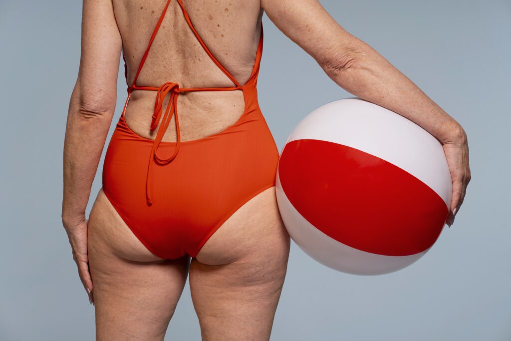 cellulite